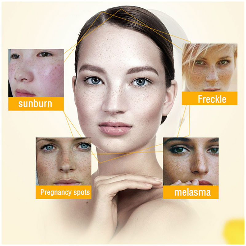 Dimollaure crema sbiancante le - Skincare Retinol recensione e prezzo