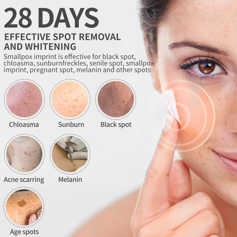 Dimollaure crema sbiancante le - Skincare Retinol recensione e prezzo
