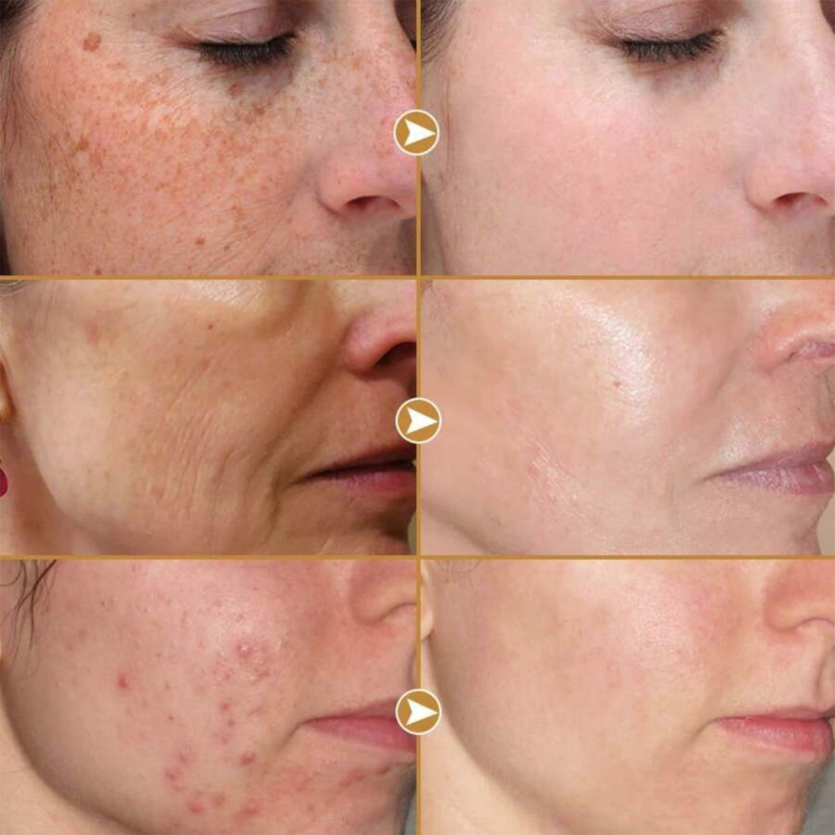 TRSTAY Peptide Composto Essenz - Peptide Neck Cream recensione e prezzo